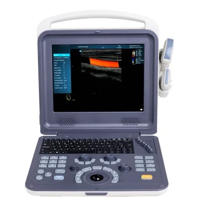 OEM Professional Medical Instruments 12 Inch 2D Image Full Digital Color Doppler Ultrasound Diagnostic System With Convex Probe