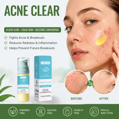 Wholesale Glutathione AHA Salicylic Acid Acne Cream Fast Effective Anti-Acne Repair Pimple Scar Redness Relief Private Label