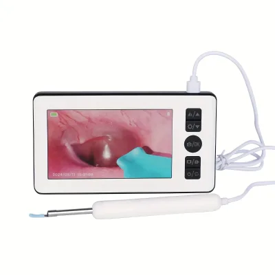 4 Inch IPS Screen HD Ear Camera Earwax Removal Tool Supports 32GB Card Supports Photo and Video Recording