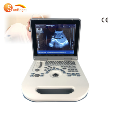 Clear Imaging 2D Laptop Professional Diagnostic Ultrasound Vet Ultrasound