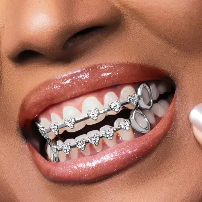 Wholesale Hip Hop Fashion Gold Teeth love Heart Full Diamond Zircon Braces Teeth Grills Personalized Trendy Dental Decoration