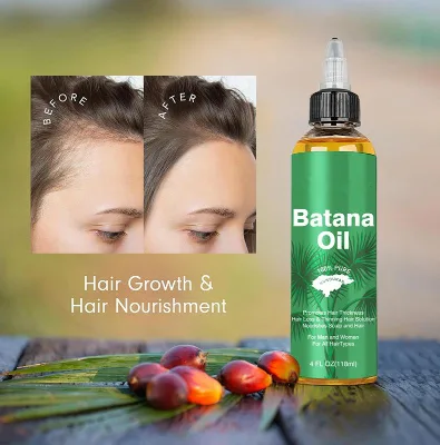 Guangzhou Manufacturer Natural Organic Smooth Repair Deeply Moisturize Dryness Prevent Hair Loss Hair Growth Batana Oil