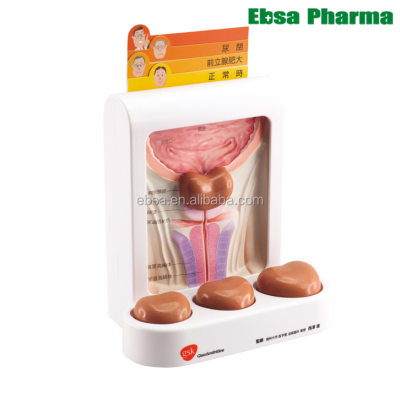 Advanced Medical Supplies Human Teaching Prostate-3 Different Sizes of Prostate With Magnets