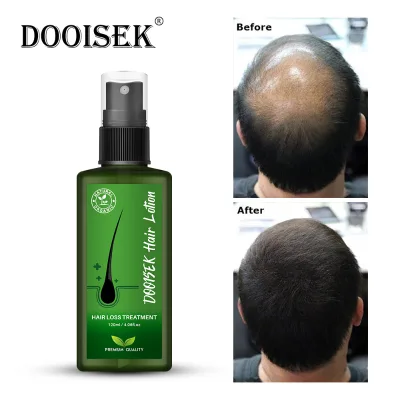 Herbal Care Rapid 120ml Men Women Hair Loss Treatment Fast Growth Serum Oil Made in Thailand Hair Lotion Hair Growth Spray