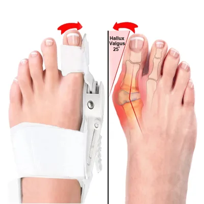 Bunion Corrector for Big Toe Press Button Bunions Correction Orthopedic Toe Straightener with Bunion Relief